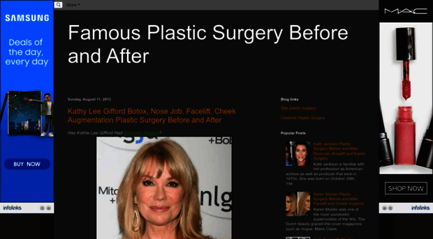 famous-plasticsurgery.blogspot.com