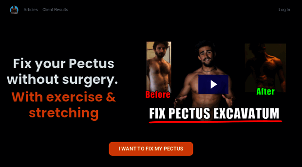 fixpectus.com