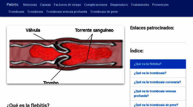 flebitis.net