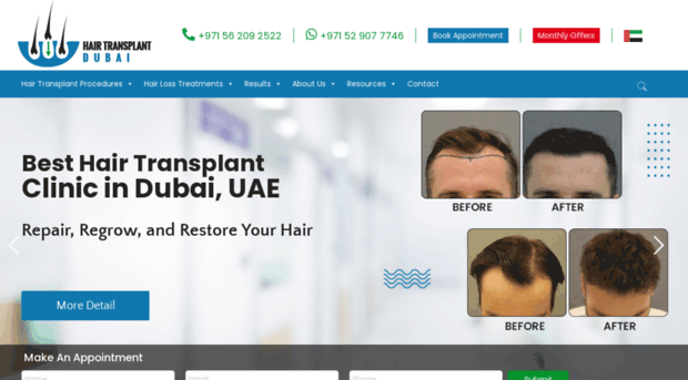 fuehairtransplantindubai.com