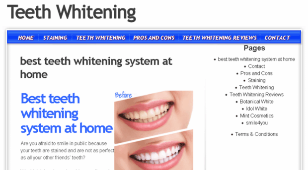 gelteethwhitening.com
