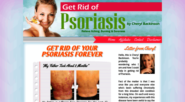 getridyourpsoriasis.com