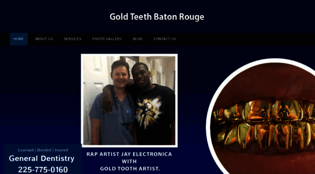 goldteethbatonrouge.com