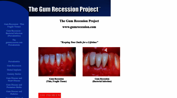 gumrecession.com