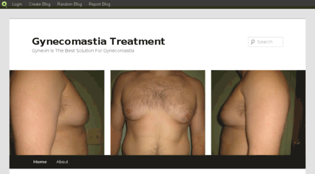 gynecomastiapills.blog.com