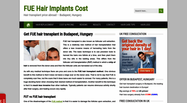 hair-implants.net