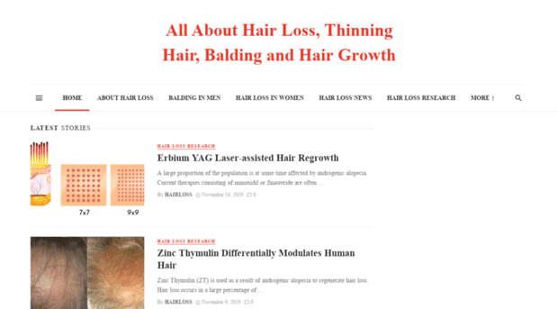 hair-loss.com