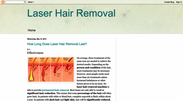 hair-remove-laser.blogspot.de