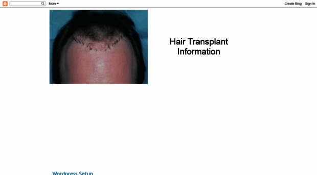 hair-transplantcost.blogspot.com