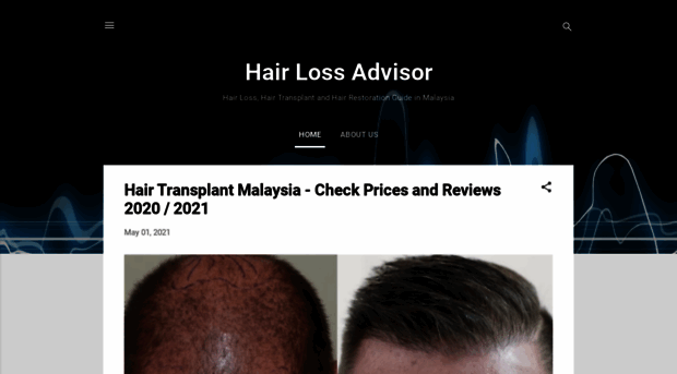 hairloss.onedaymd.com