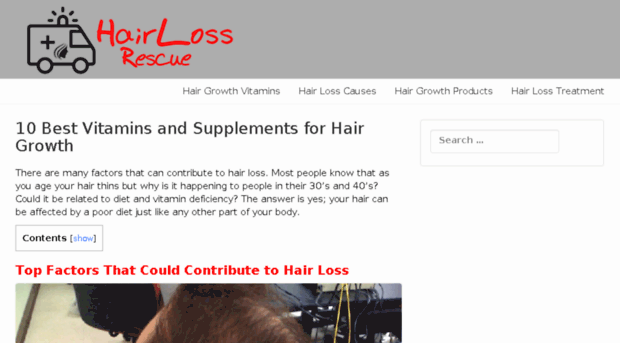 hairlossrescue.biz