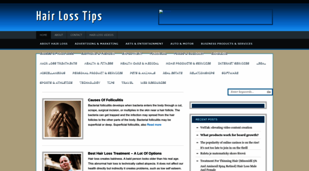 hairlosstipsguide.com