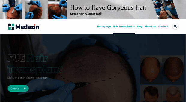 hairtransplantall.com