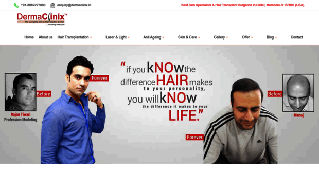 hairtransplantghaziabad.dermaclinix.in