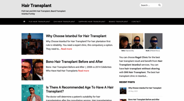 hairtransplantinfo.net