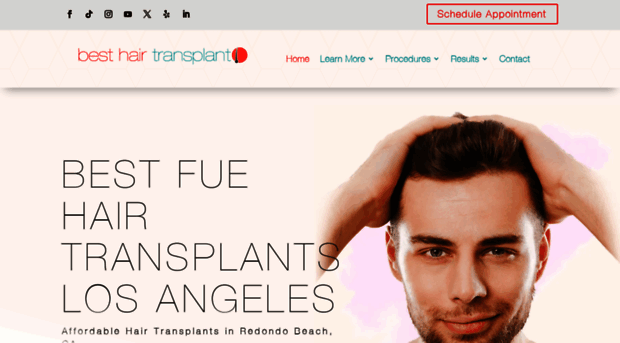 hairtransplantslosangeles.com