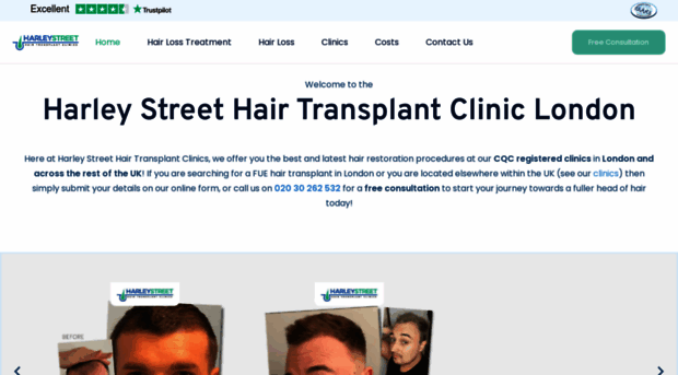 harleystreethairtransplant.co.uk