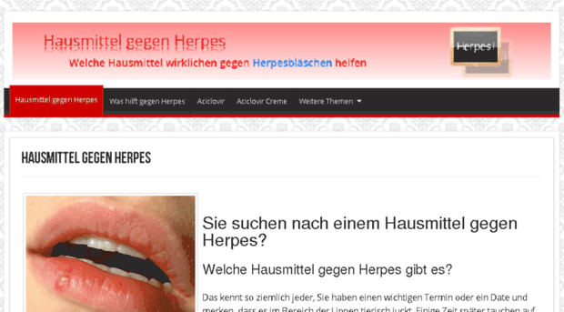 hausmittel-gegen-herpes.de