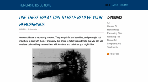 hemorrhoidsbegone1.weebly.com