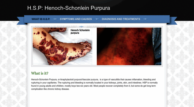 henochschonleinpurpura.weebly.com