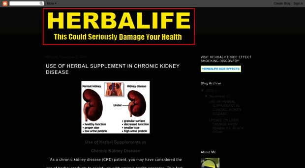 herbalife-kidney-effect.blogspot.in