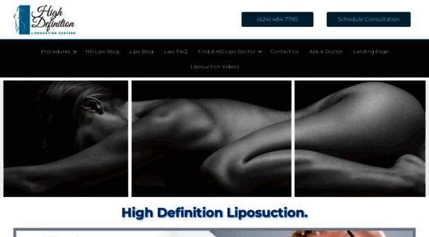 highdefinitionliposuction.com