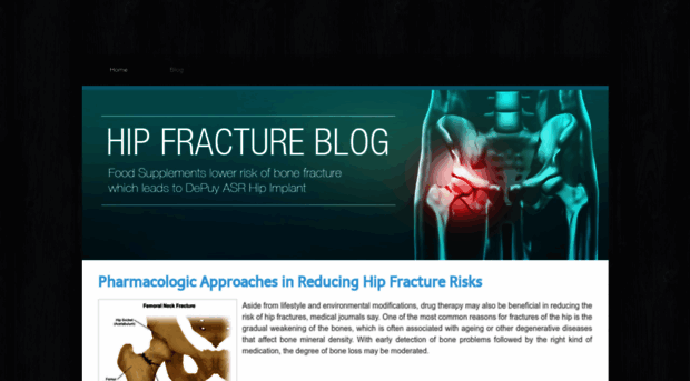 hipfractures.weebly.com