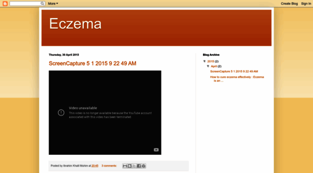 howtocureeczema.blogspot.com