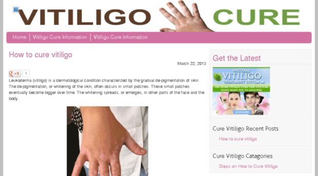 howtocurevitiligo.net