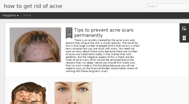 howtogetridof-acne.com