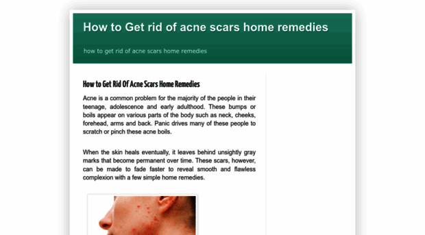 howtogetridofacnescarshomeremedies9.blogspot.com