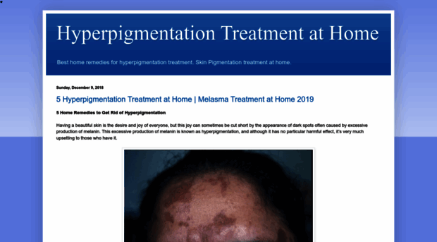 hyperpigmentationtreatmentcream.blogspot.com