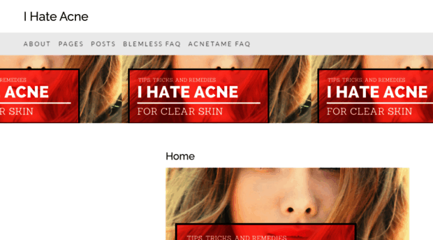 ihateacne.net