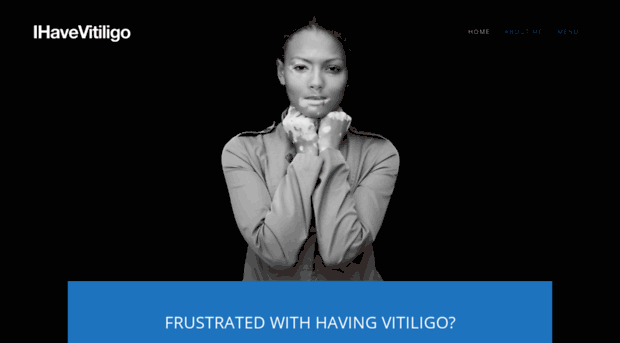 ihavevitiligo.com