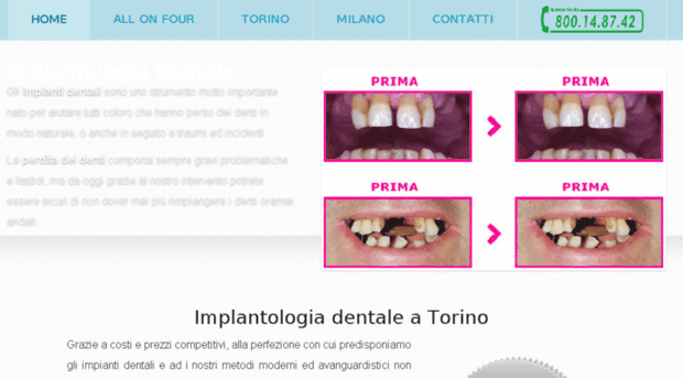 impianti-dentali.info