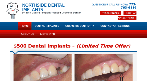 implant500.com