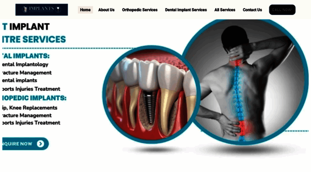 implantcentre.in