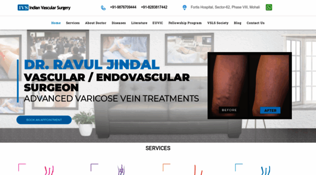 indianvascularsurgery.com