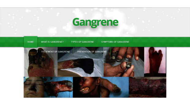 infoongangrene.weebly.com