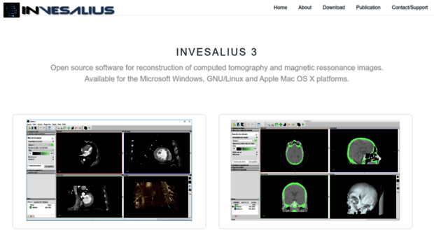 invesalius.github.io