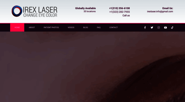 irexlaser.com