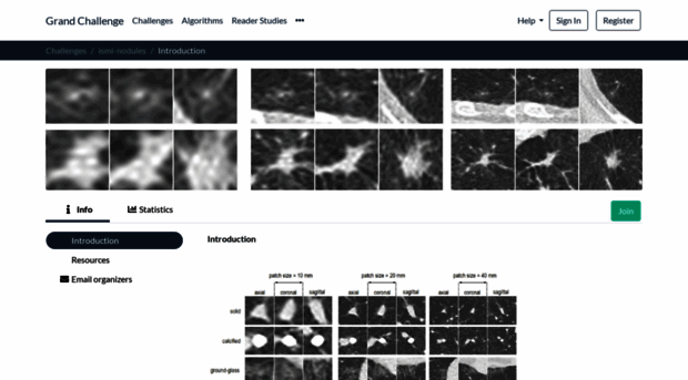 ismi-nodules.grand-challenge.org