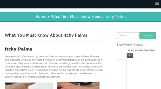 itchypalms.net