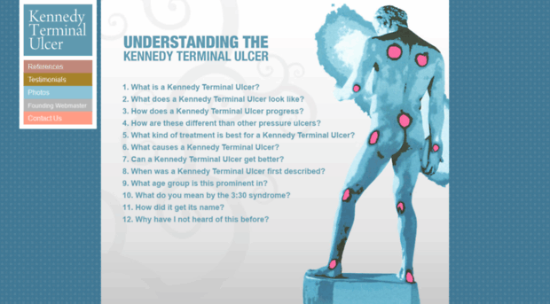 kennedyterminalulcer.com