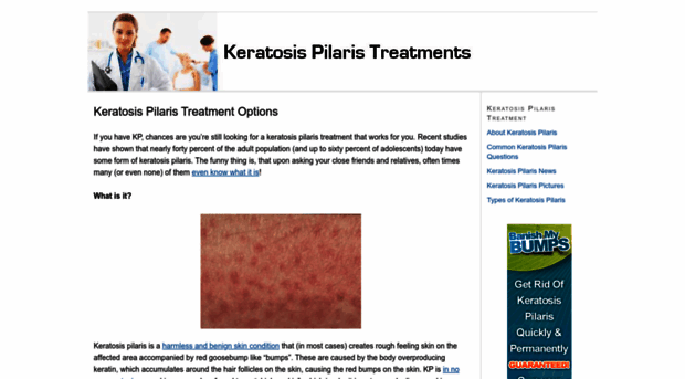 keratosistreatments.com