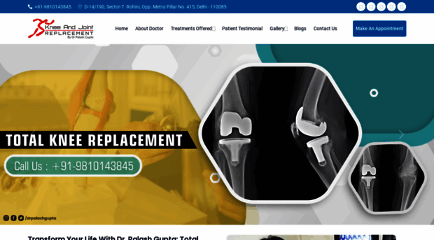 kneejointsreplacement.com