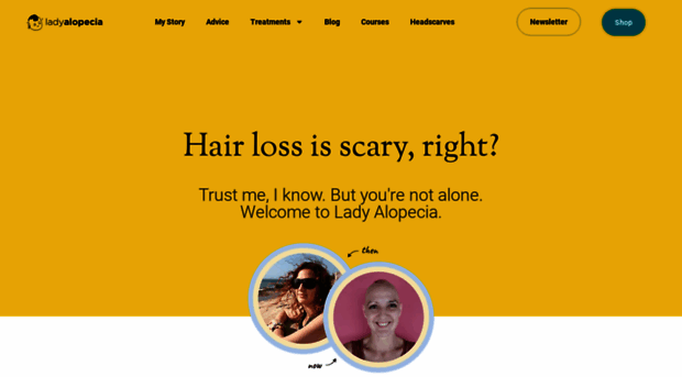 ladyalopecia.com