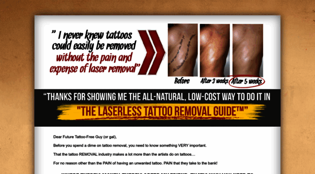 laserlesstattooremoval.com