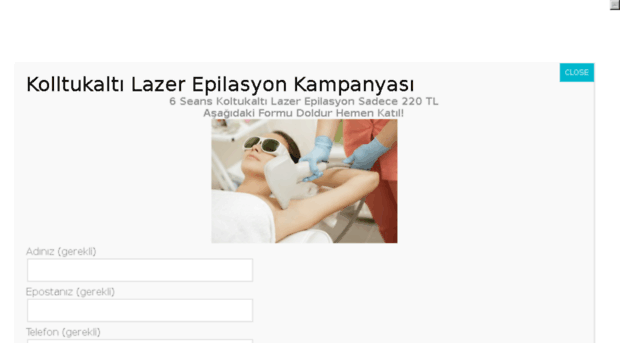 lazerepilasyona.com