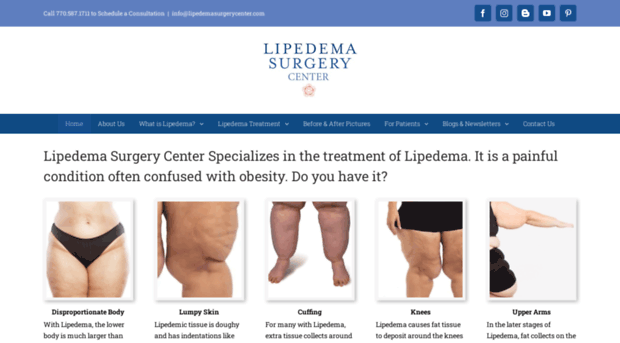 lipedemaliposuctioncenter.com